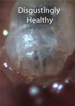 Disgustingly Healthy, Maggots