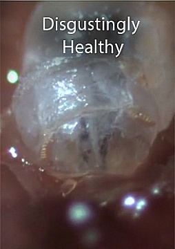 Watch Full Movie - Disgustingly Healthy, Maggots