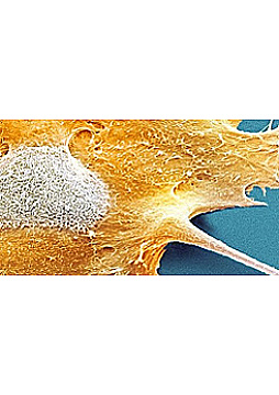 Watch Full Movie - On DNA Mutation